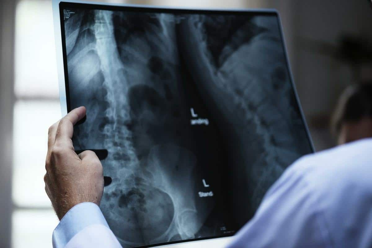 Chiropractor in omaha holds up xray to diagnose a personal injury