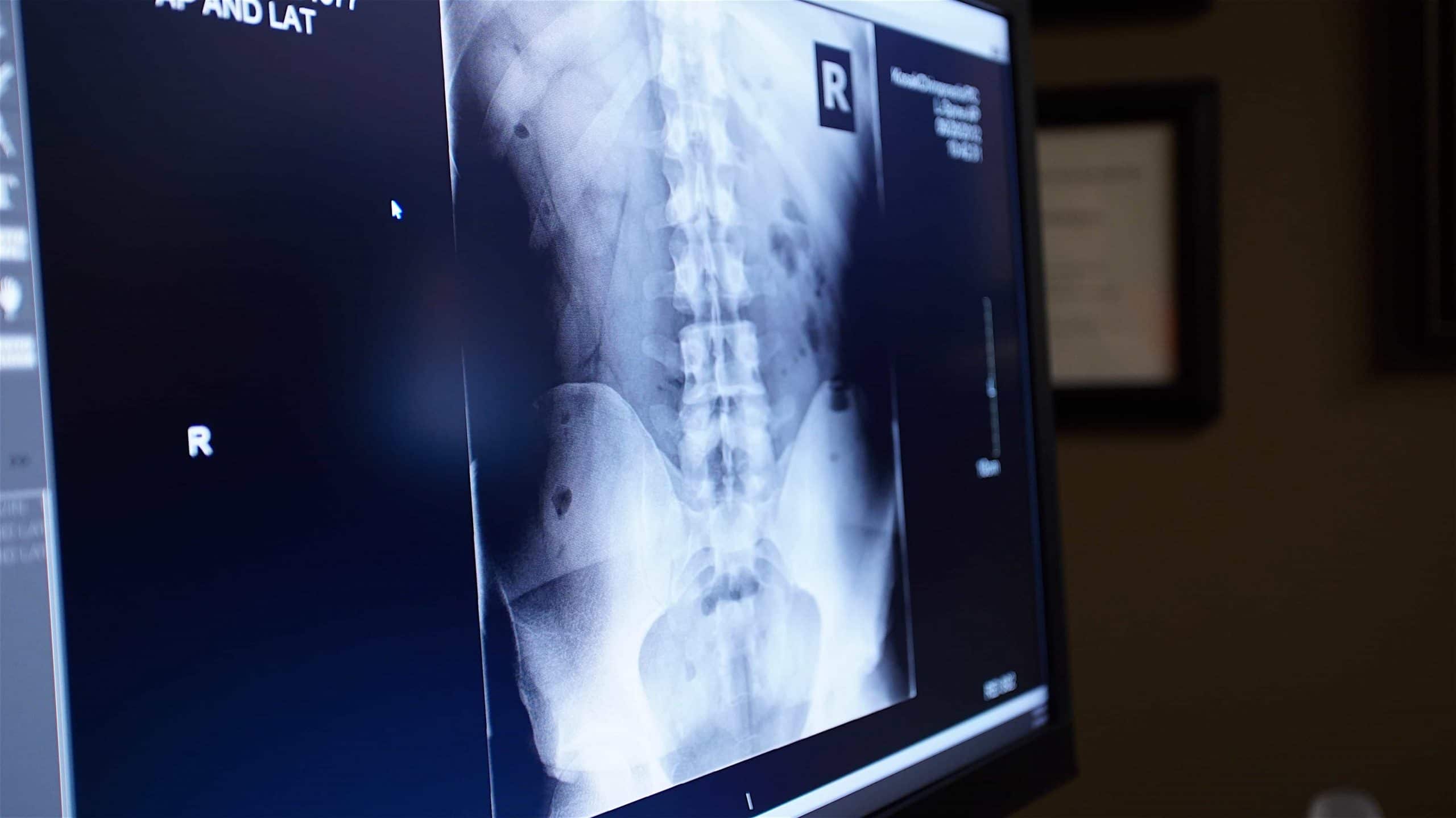 Images and xrays are shown to patients who just had a personal injury experience