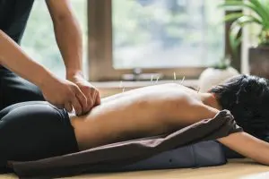 woman receiving acupuncture treatment