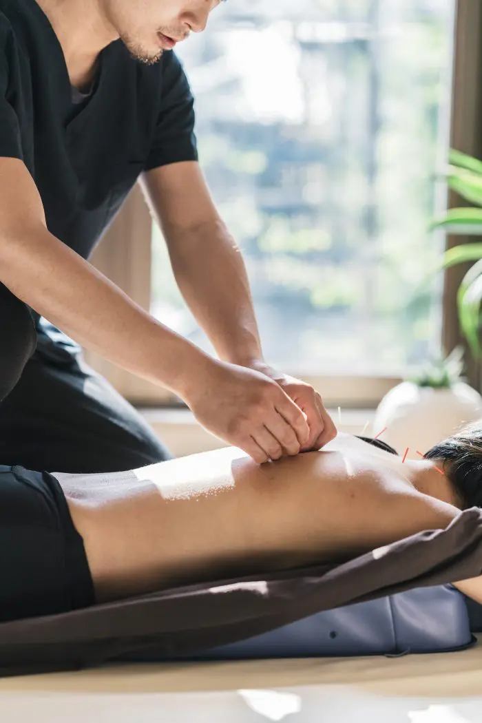 patient receiving acupuncture treatment 