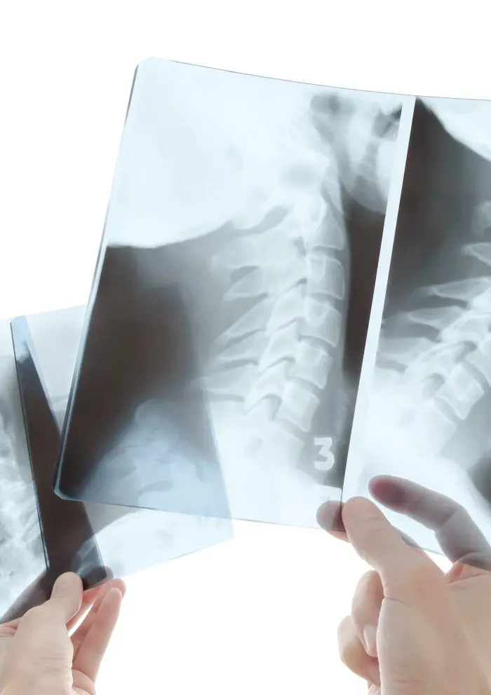 chiropractor looking at patient neck x-rays