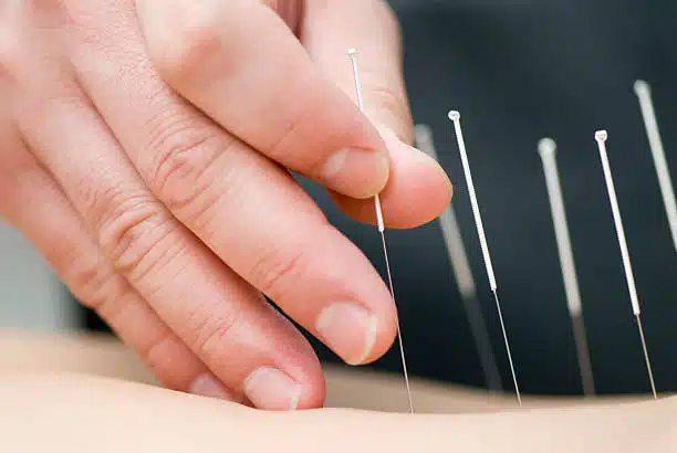 Pain Treatment through needle